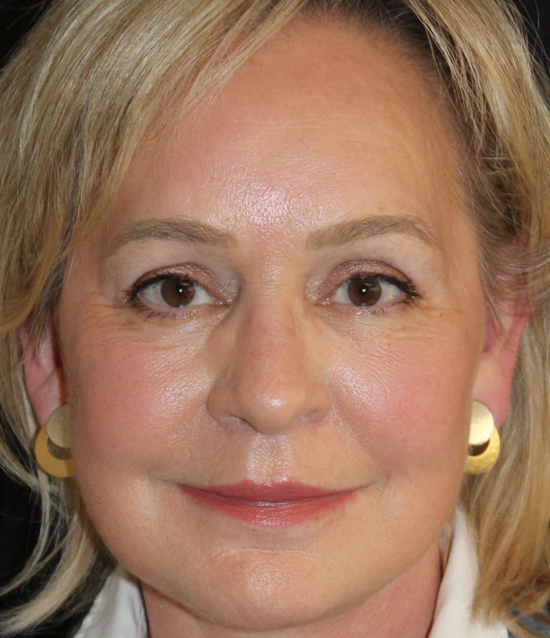 Patient 99 After Image