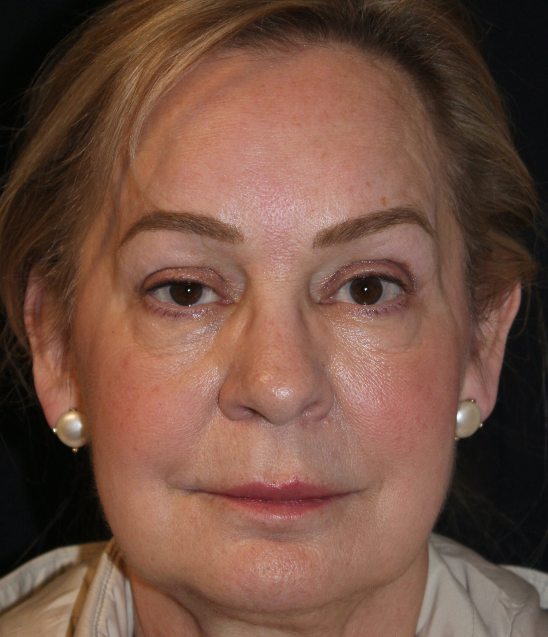 Patient 99 Before Image