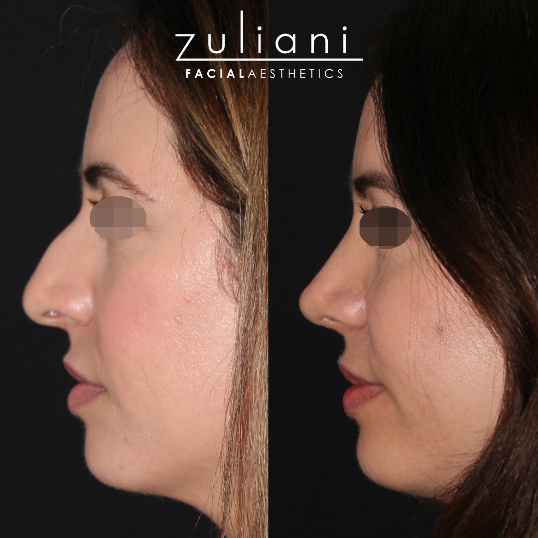 Patient #108 Marge Image