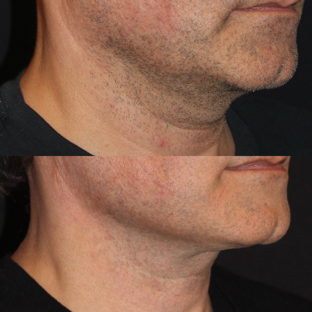 Patient #145 Marge Image