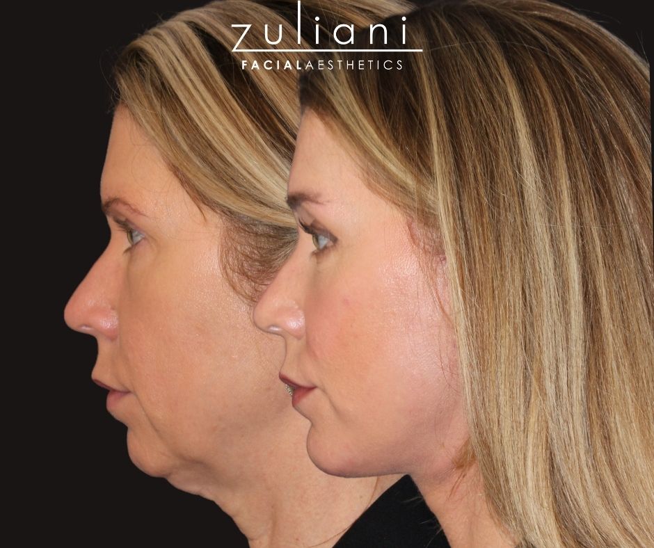 Patient #191 Marge Image