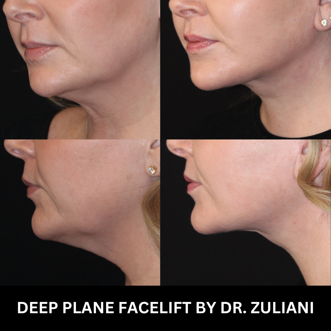 Patient #167 Marge Image