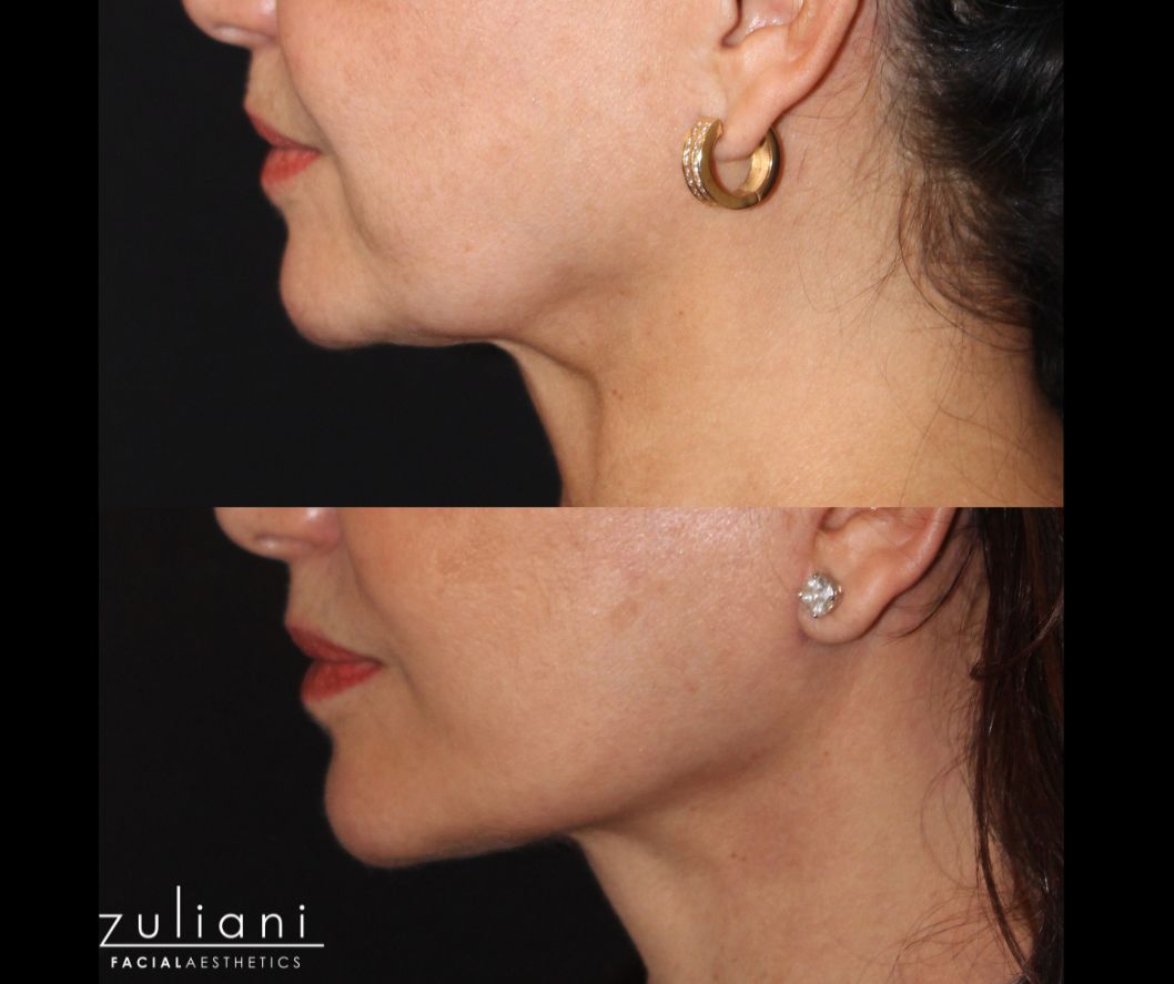 Patient #186 Marge Image