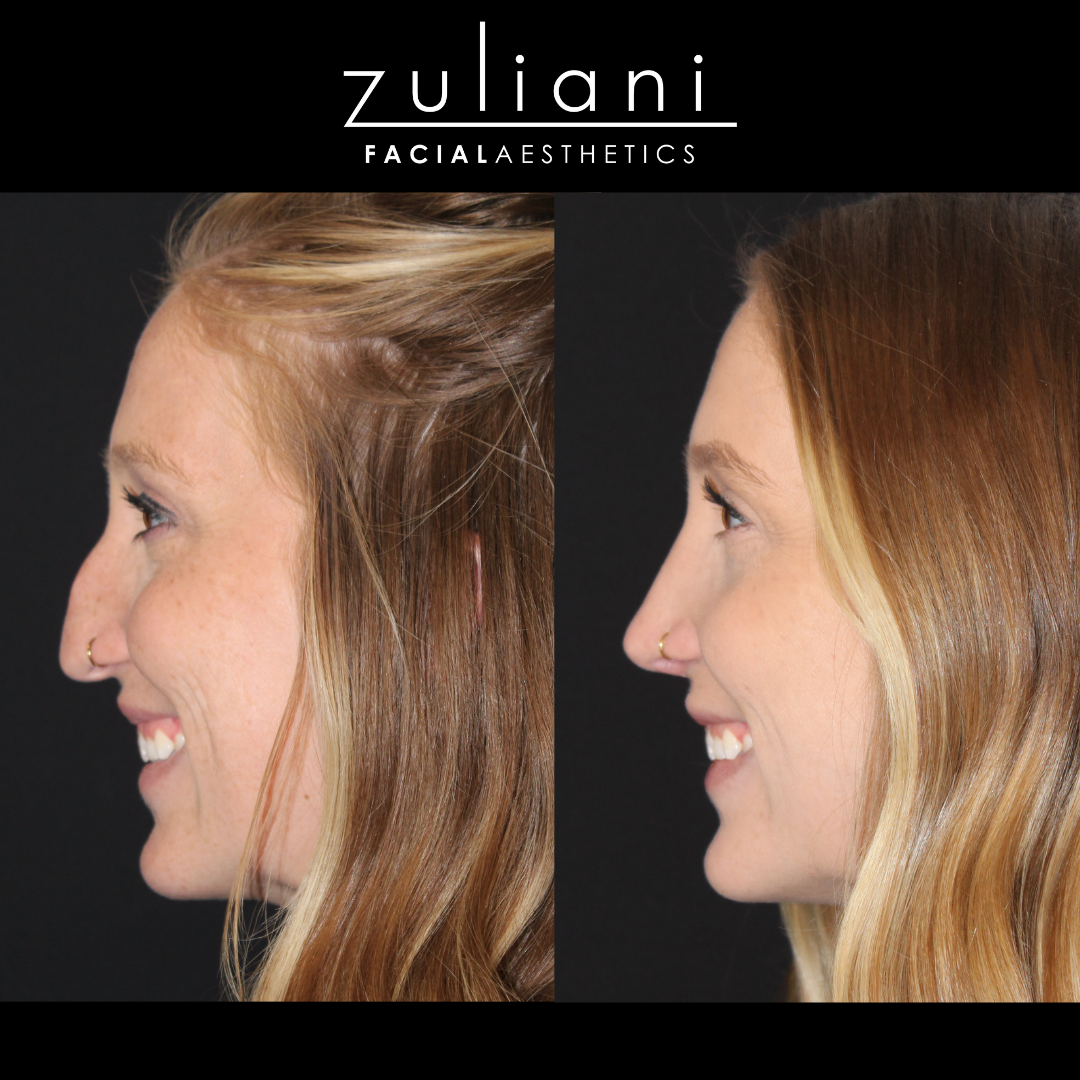 Patient #133 Marge Image