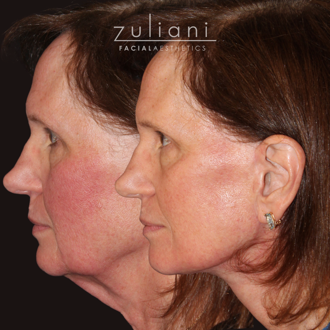 Patient #185 Marge Image