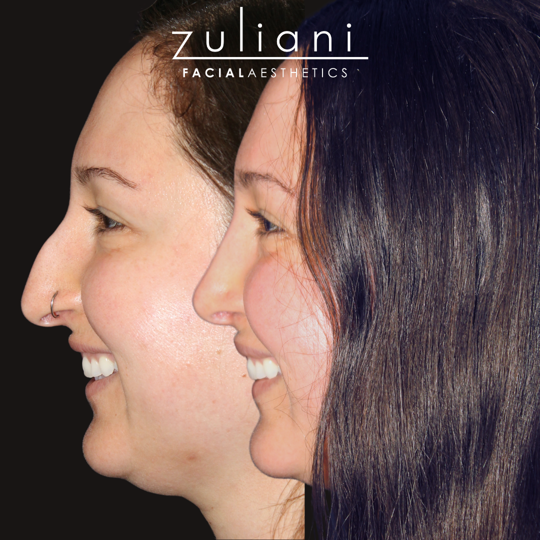 Patient #192 Marge Image