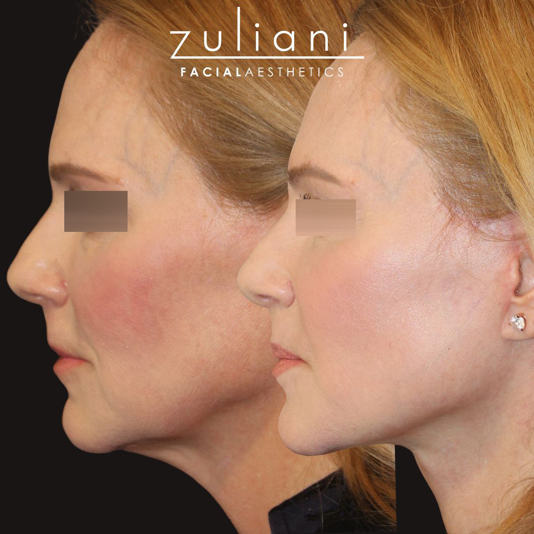 Patient #190 Marge Image