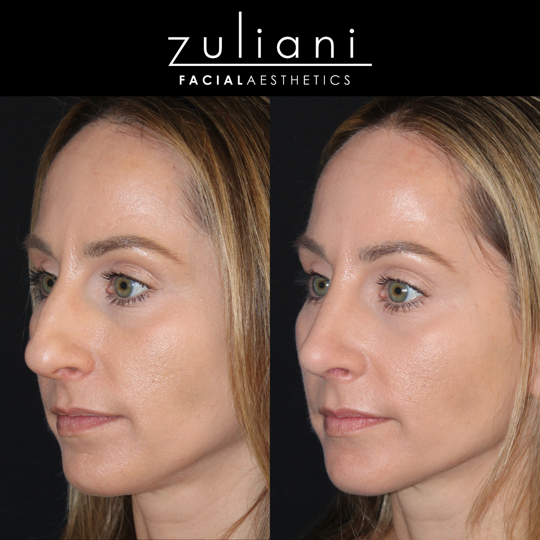 Patient #137 Marge Image