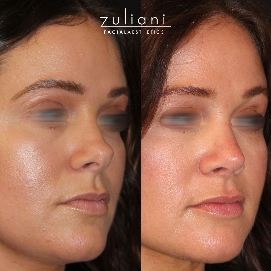 Patient #178 Marge Image