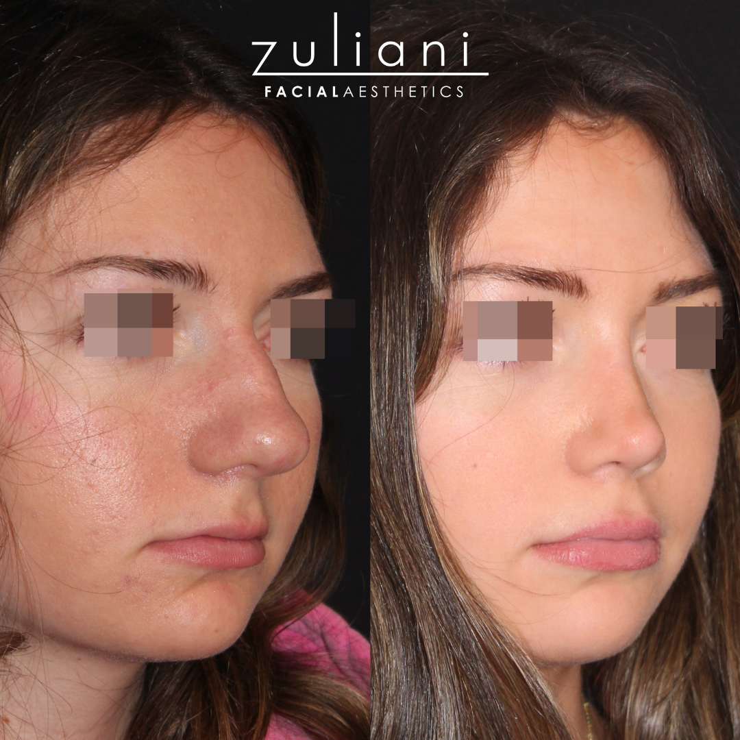 Patient #184 Marge Image