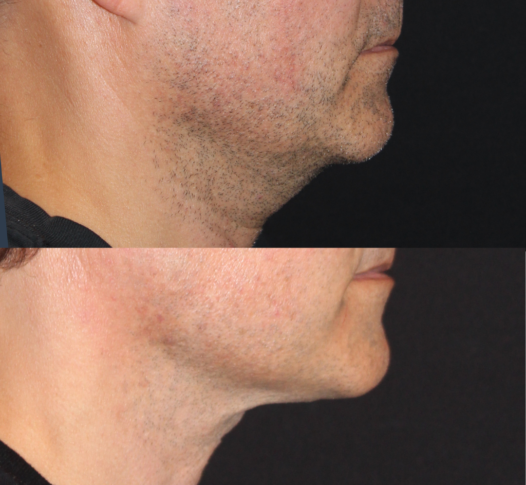 Patient #145 Marge Image