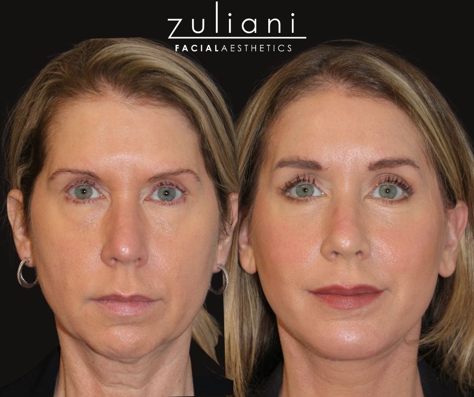 Patient #191 Marge Image