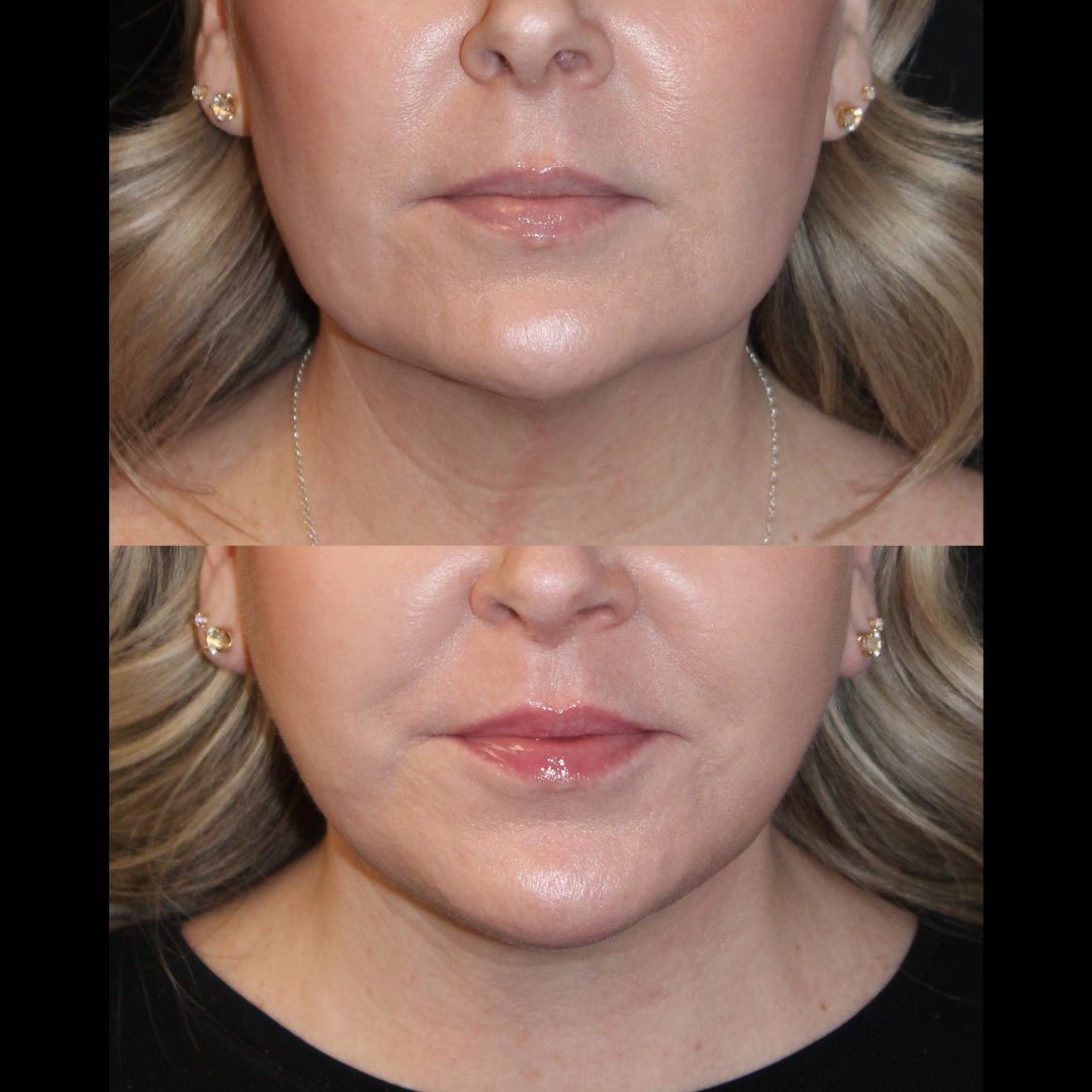 Patient #167 Marge Image