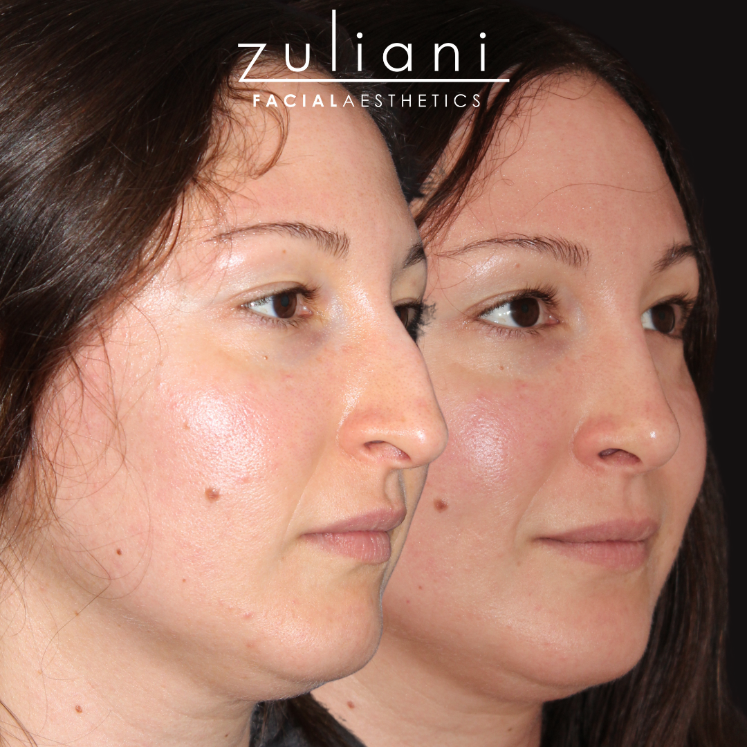 Patient #192 Marge Image