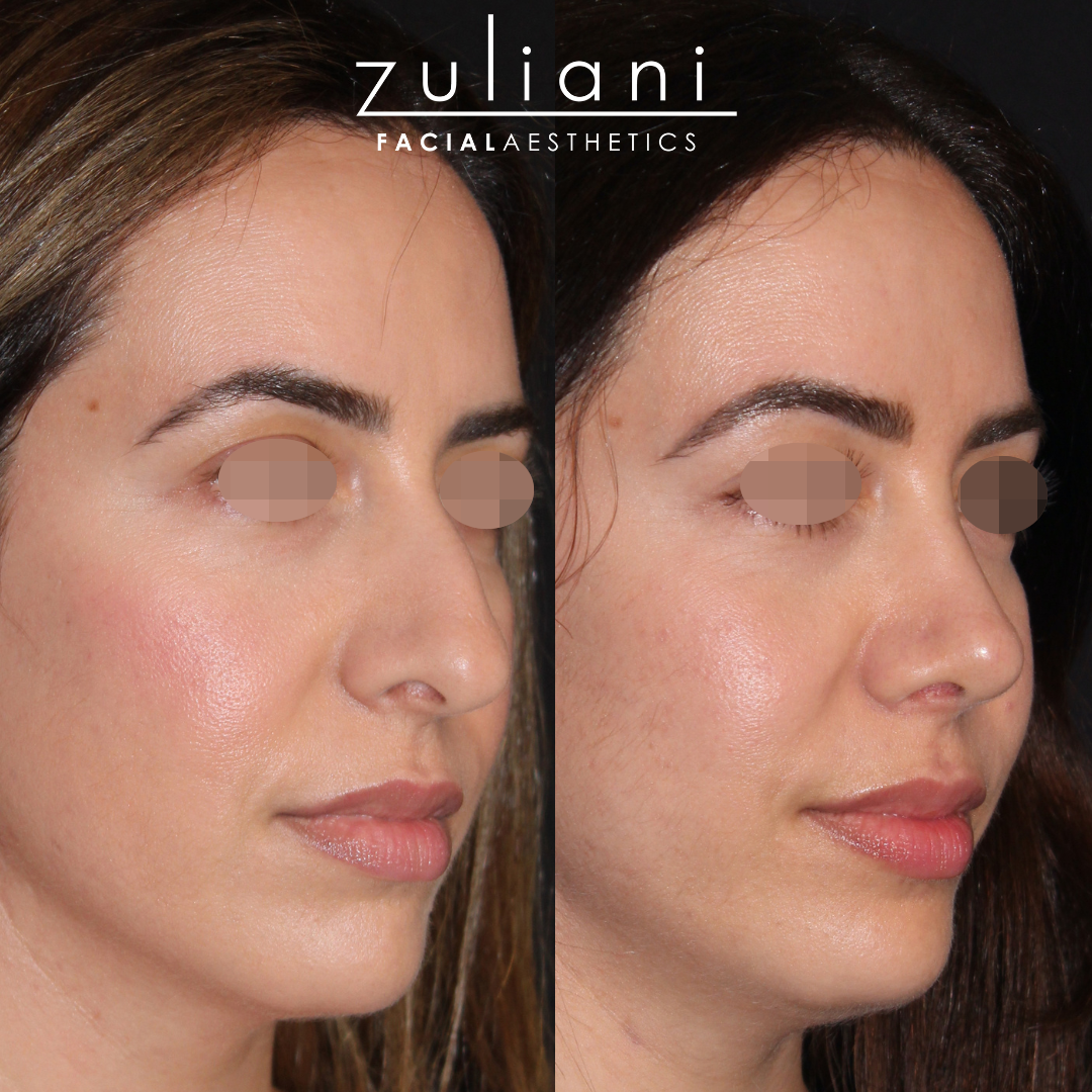 Patient #108 Marge Image