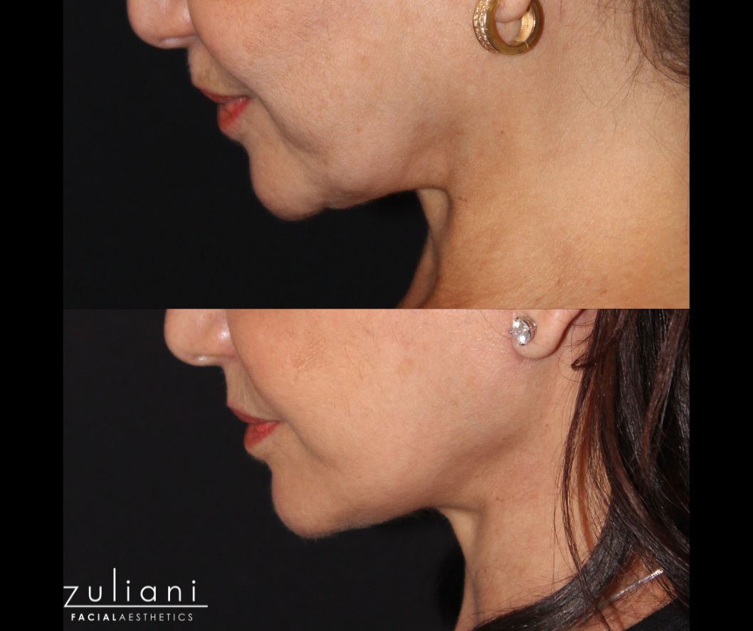 Patient #186 Marge Image