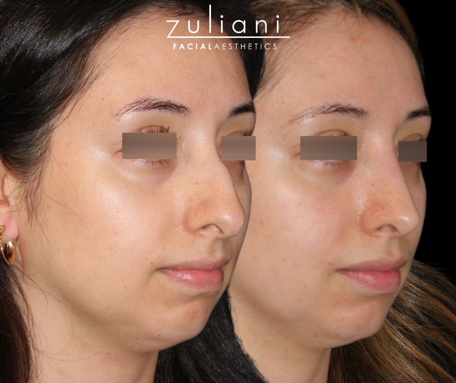 Patient #187 Marge Image