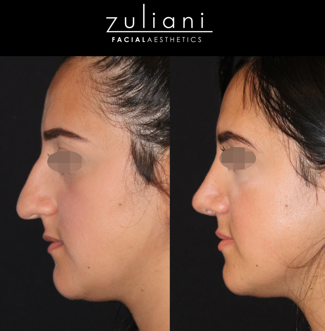 Patient #120 Marge Image