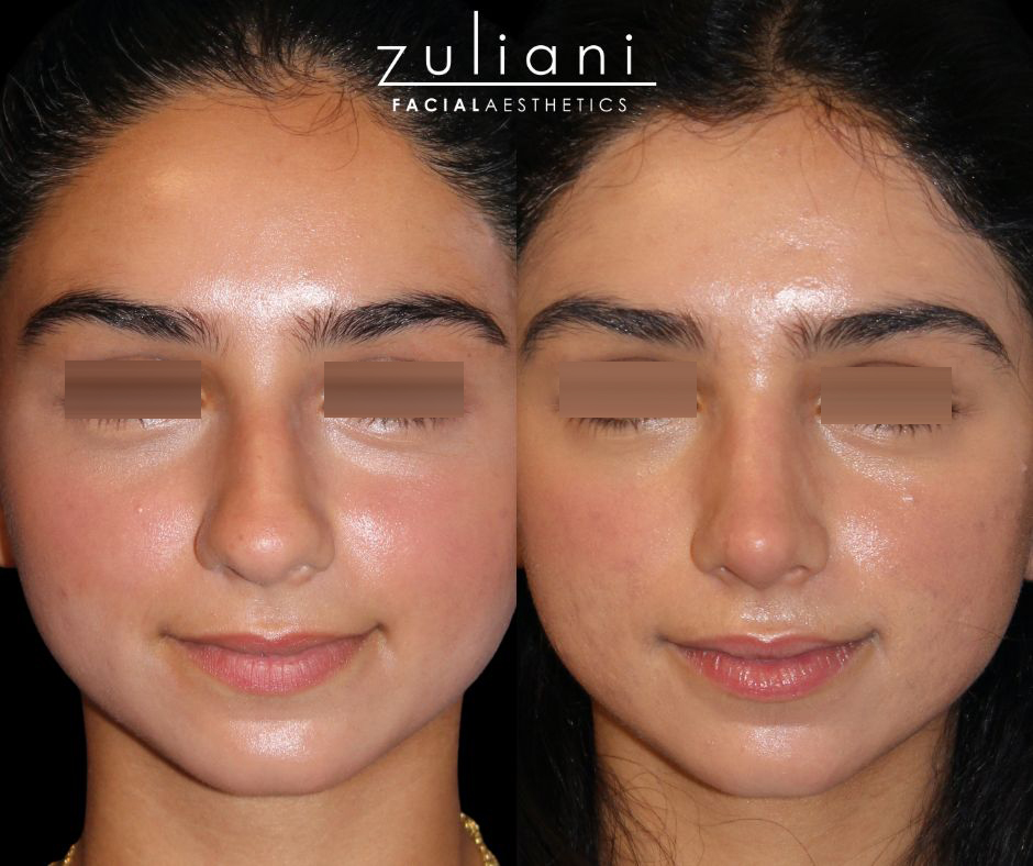 Patient #188 Marge Image