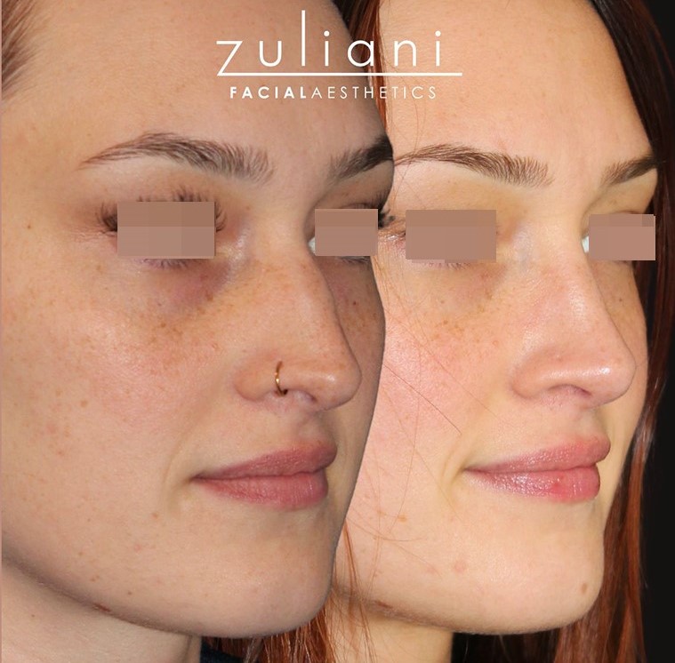 Patient #189 Marge Image