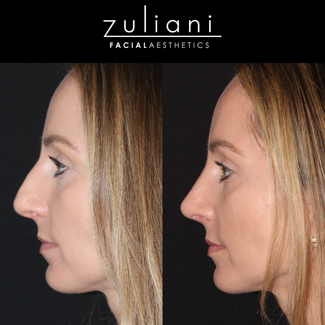 Patient #137 Marge Image