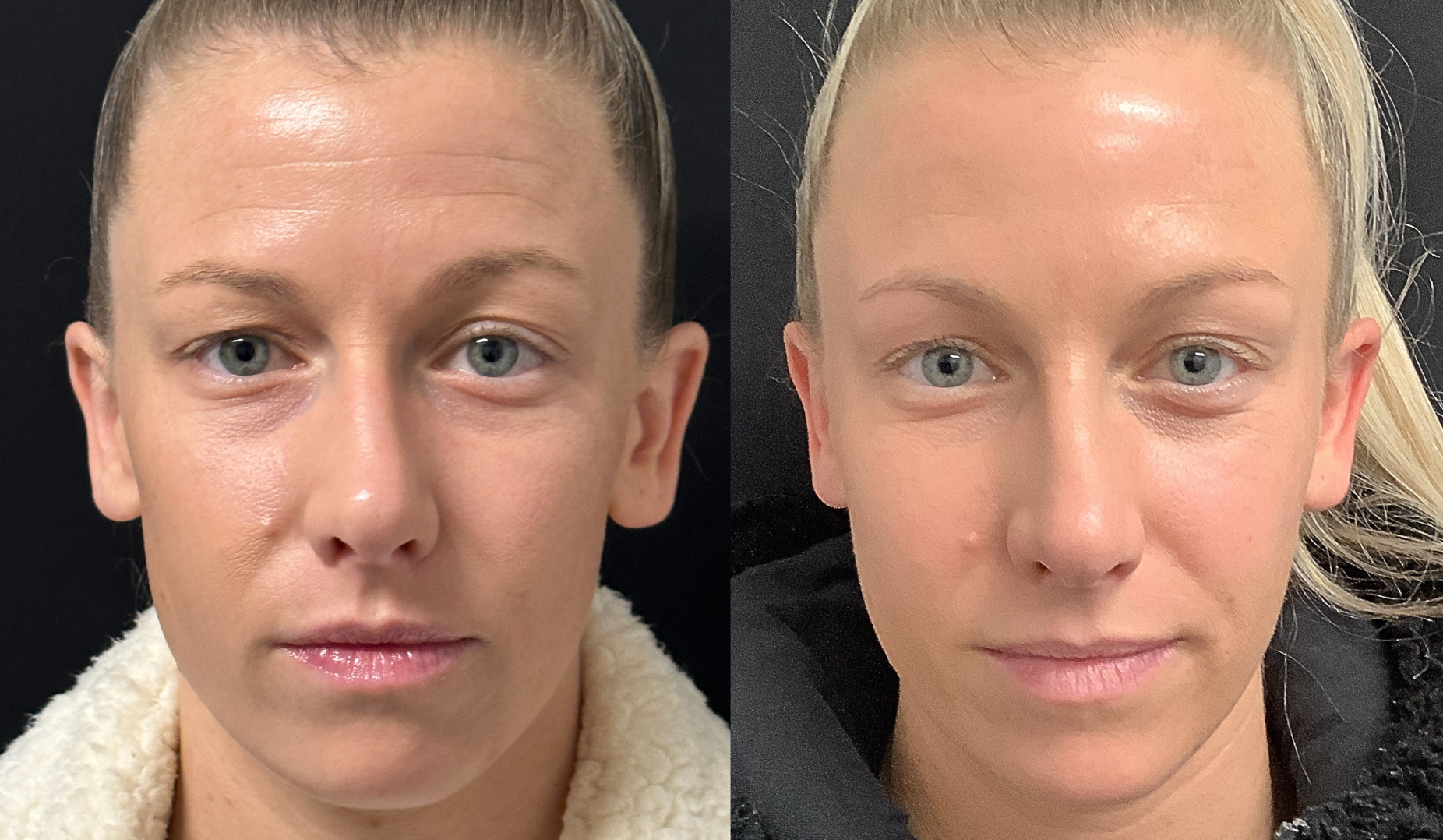 Patient 100 Marge Image