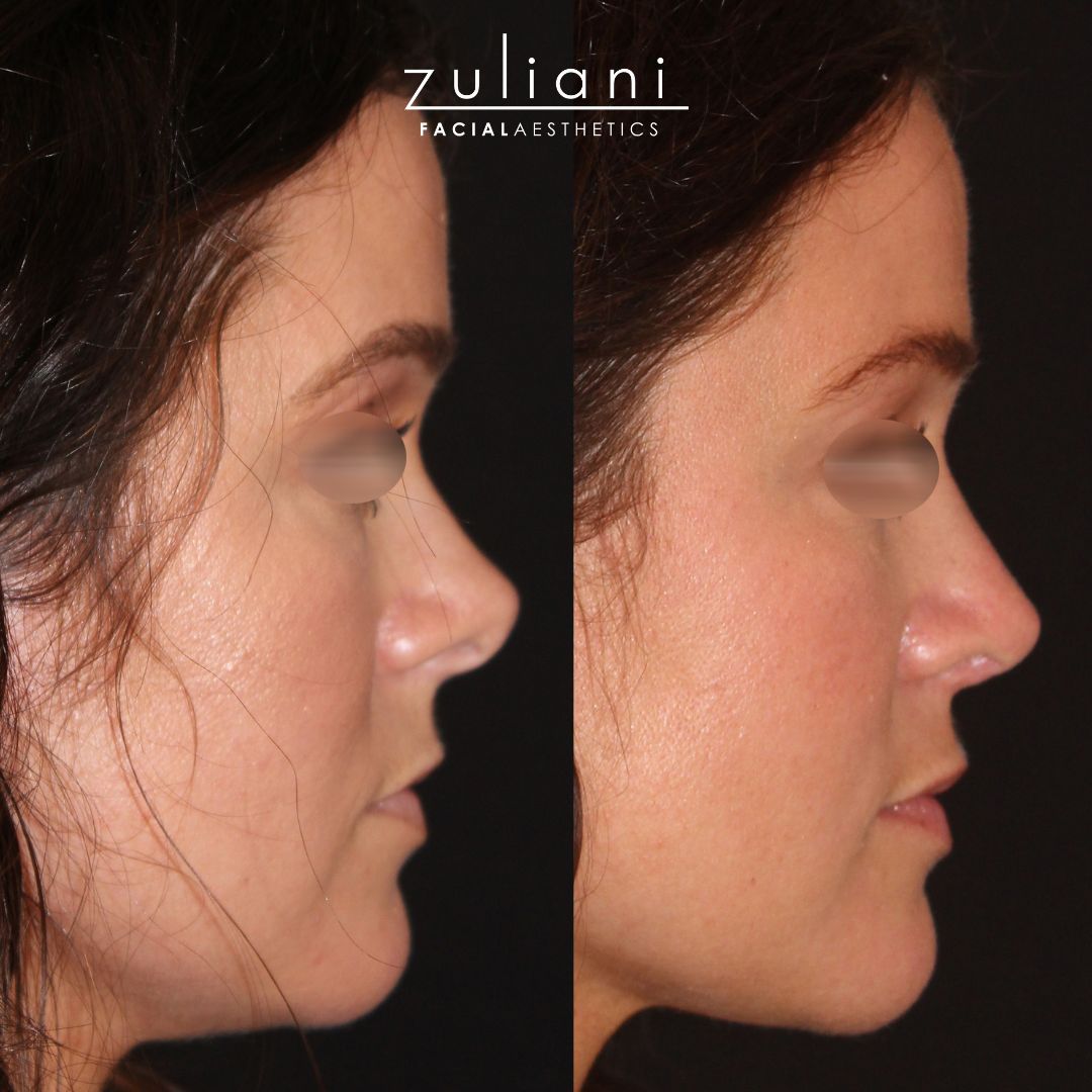 Patient #178 Marge Image