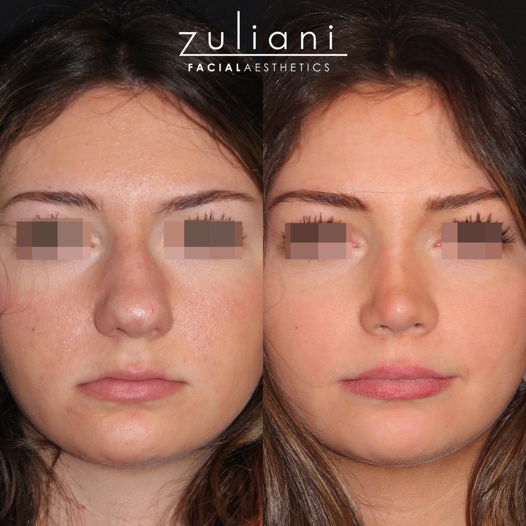 Patient #184 Marge Image