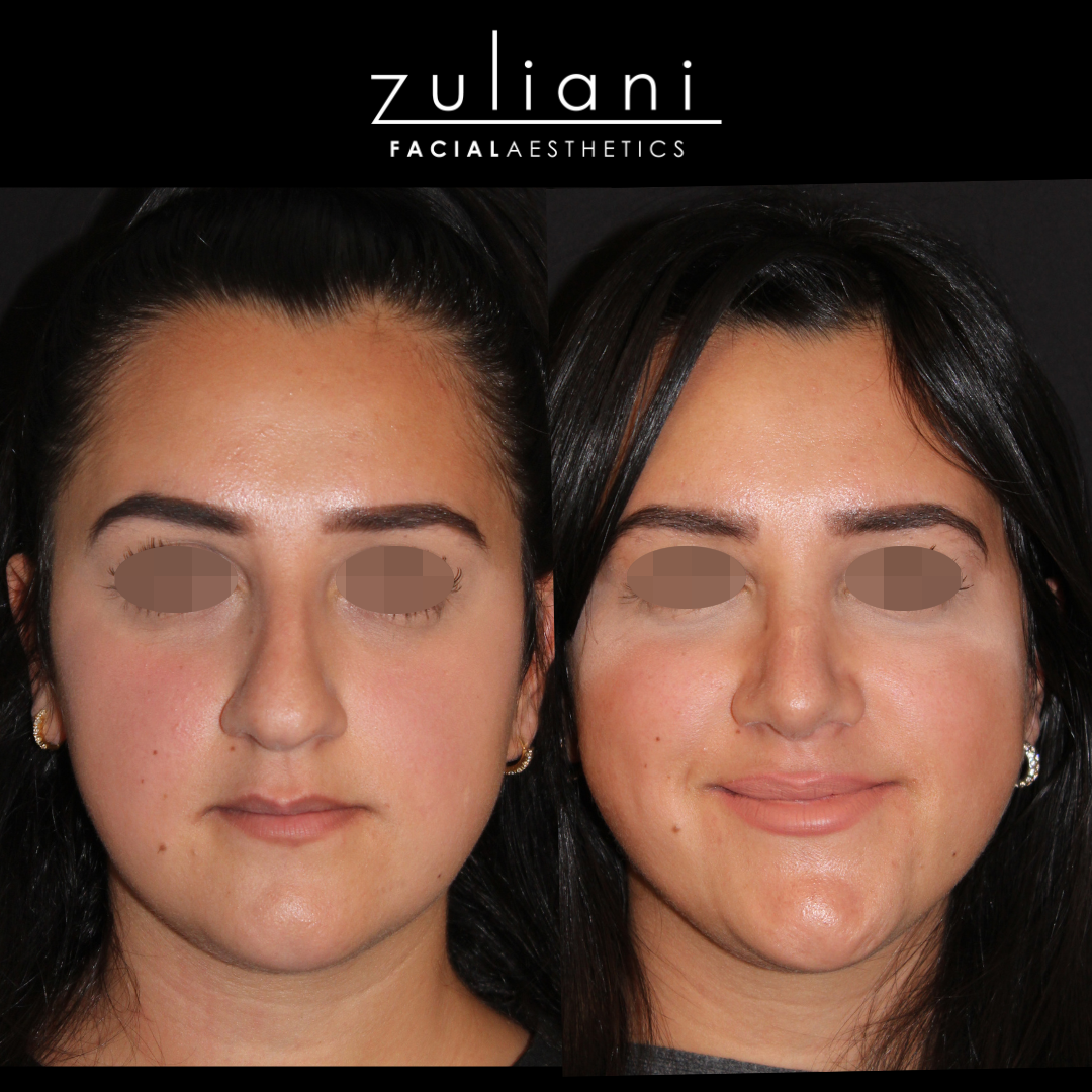 Patient #120 Marge Image