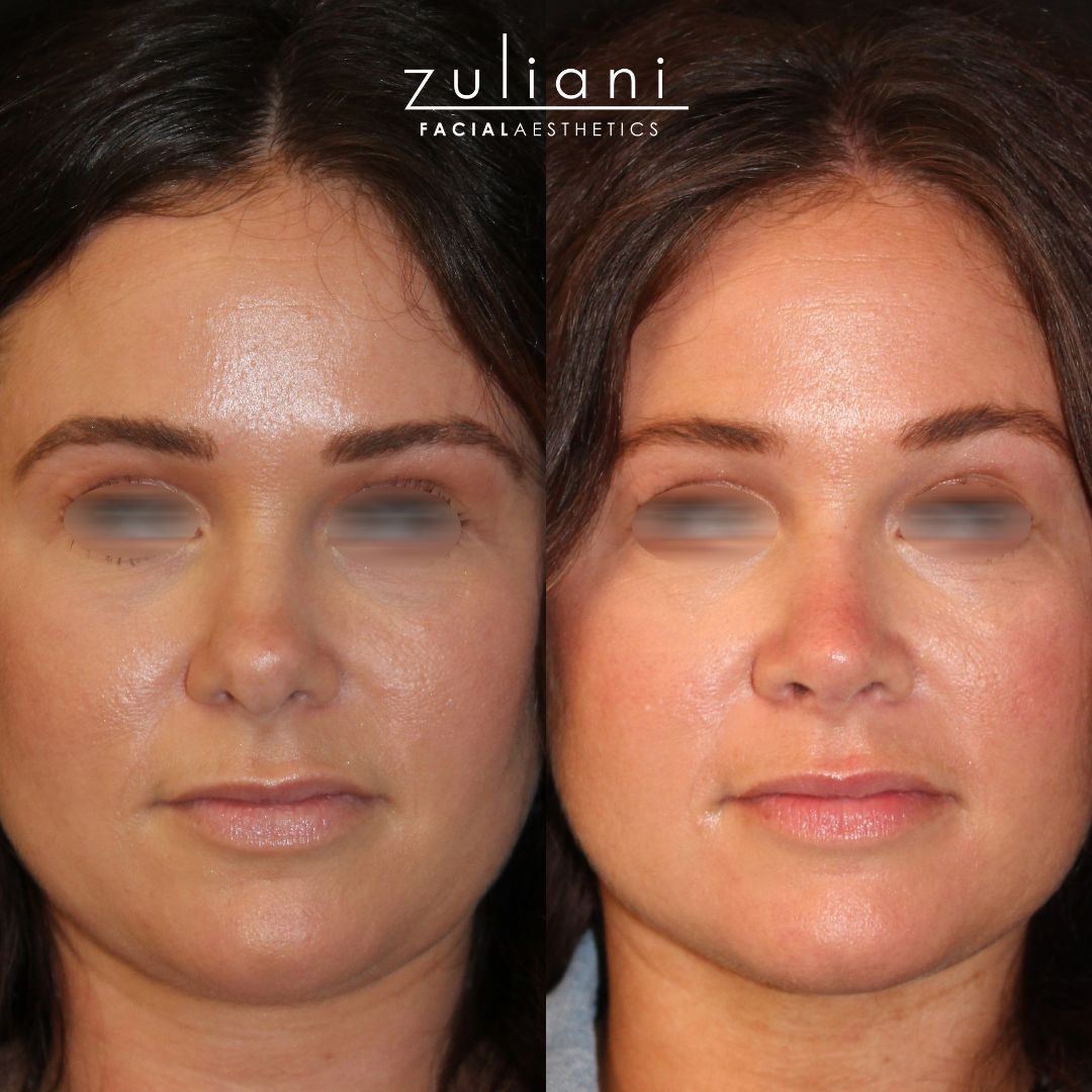 Patient #178 Marge Image