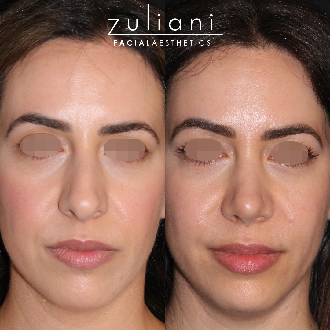 Patient #108 Marge Image