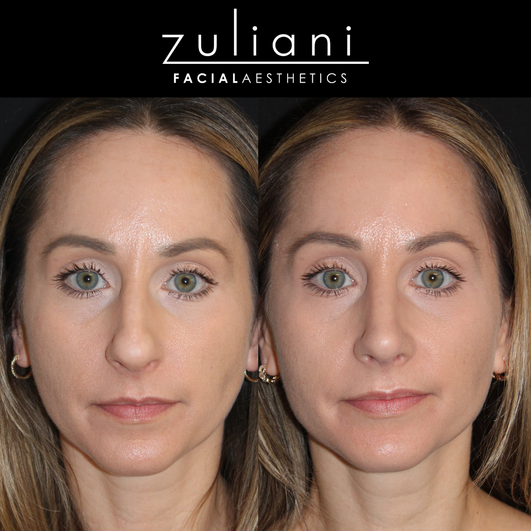 Patient #137 Marge Image