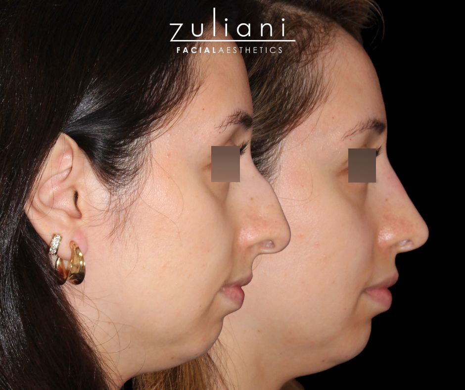 Patient #187 Marge Image