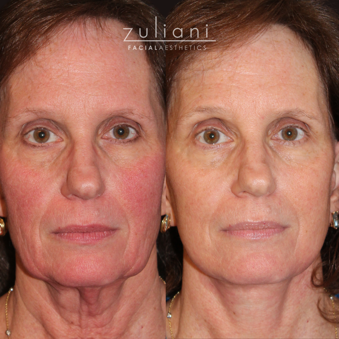 Patient #185 Marge Image