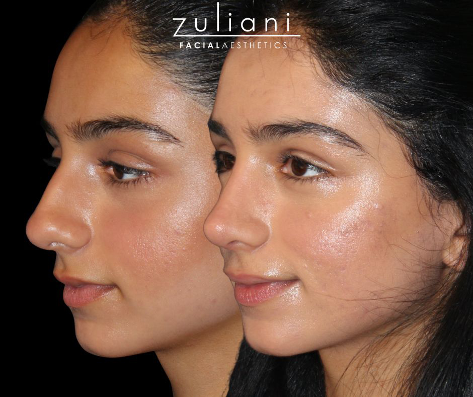 Patient #188 Marge Image