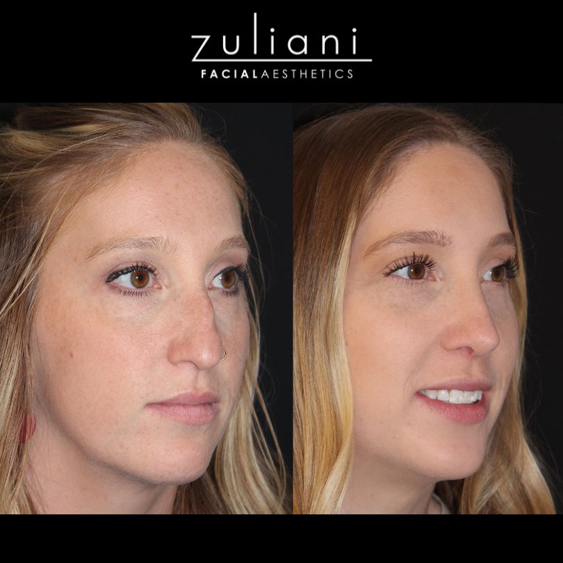 Patient #133 Marge Image