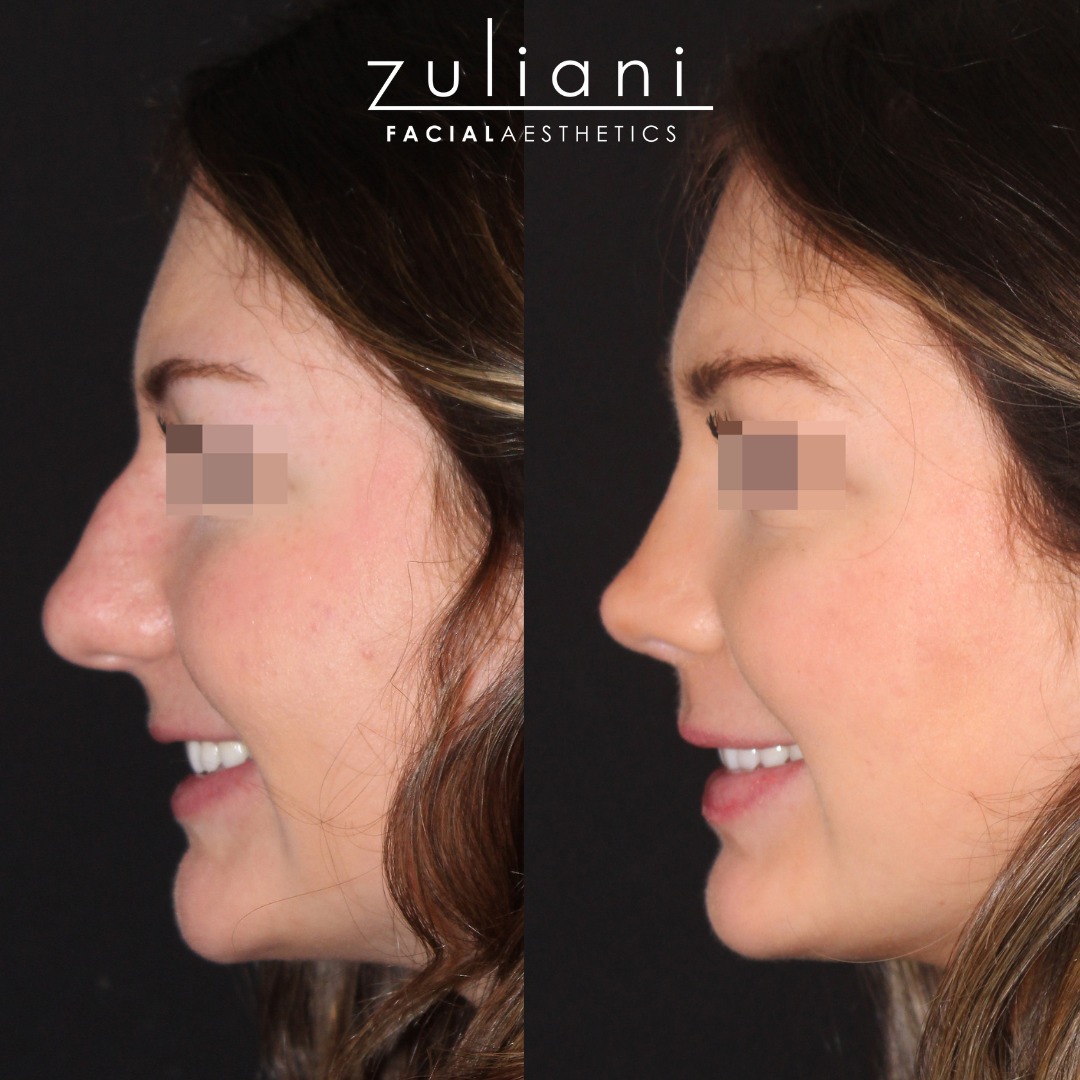 Patient #184 Marge Image