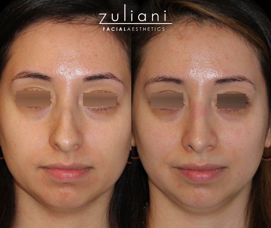 Patient #187 Marge Image