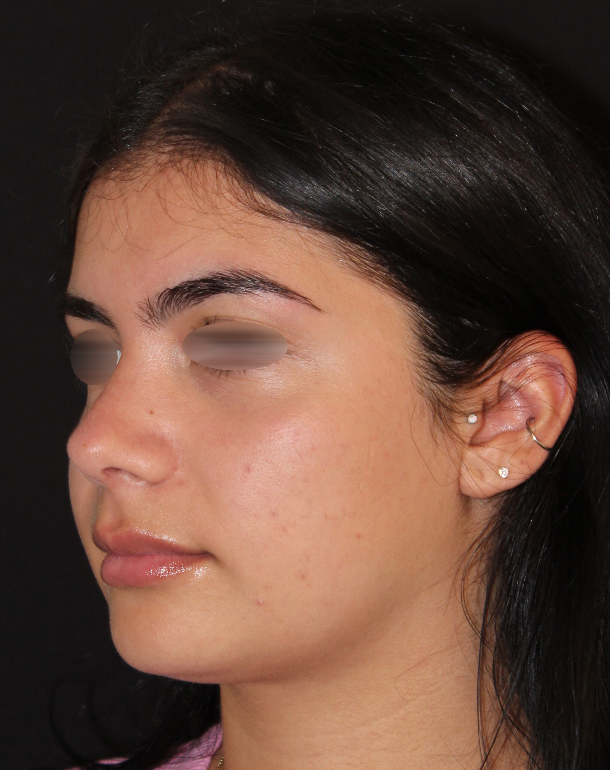 Patient #142 After Image