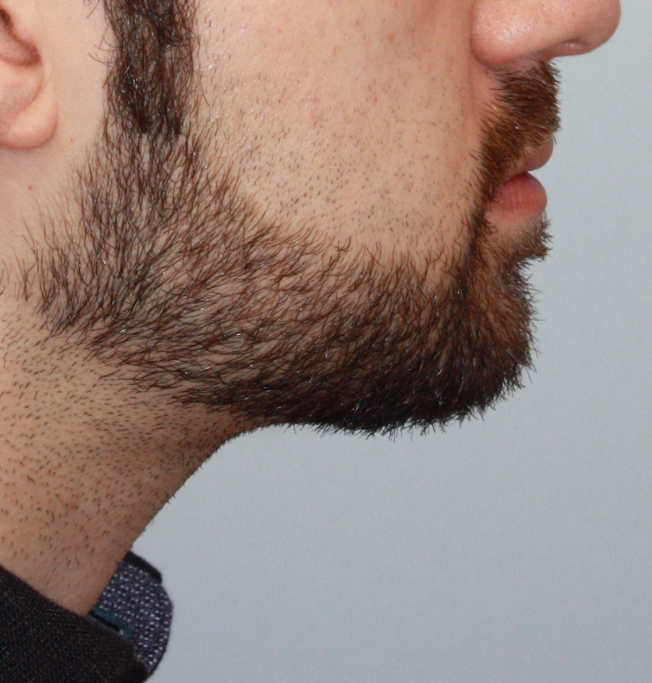 Patient 37 After Image