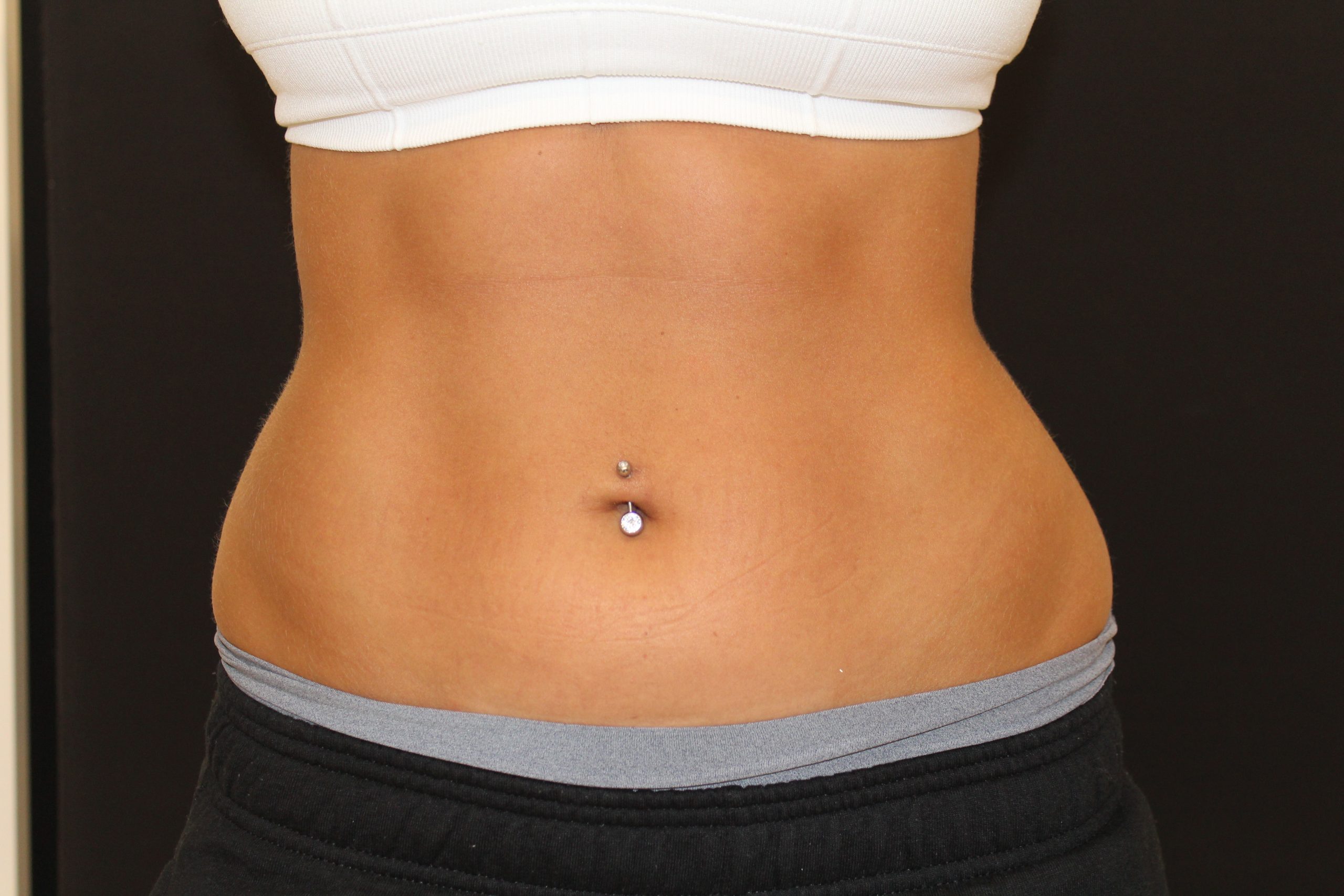 Patient 53 After Image