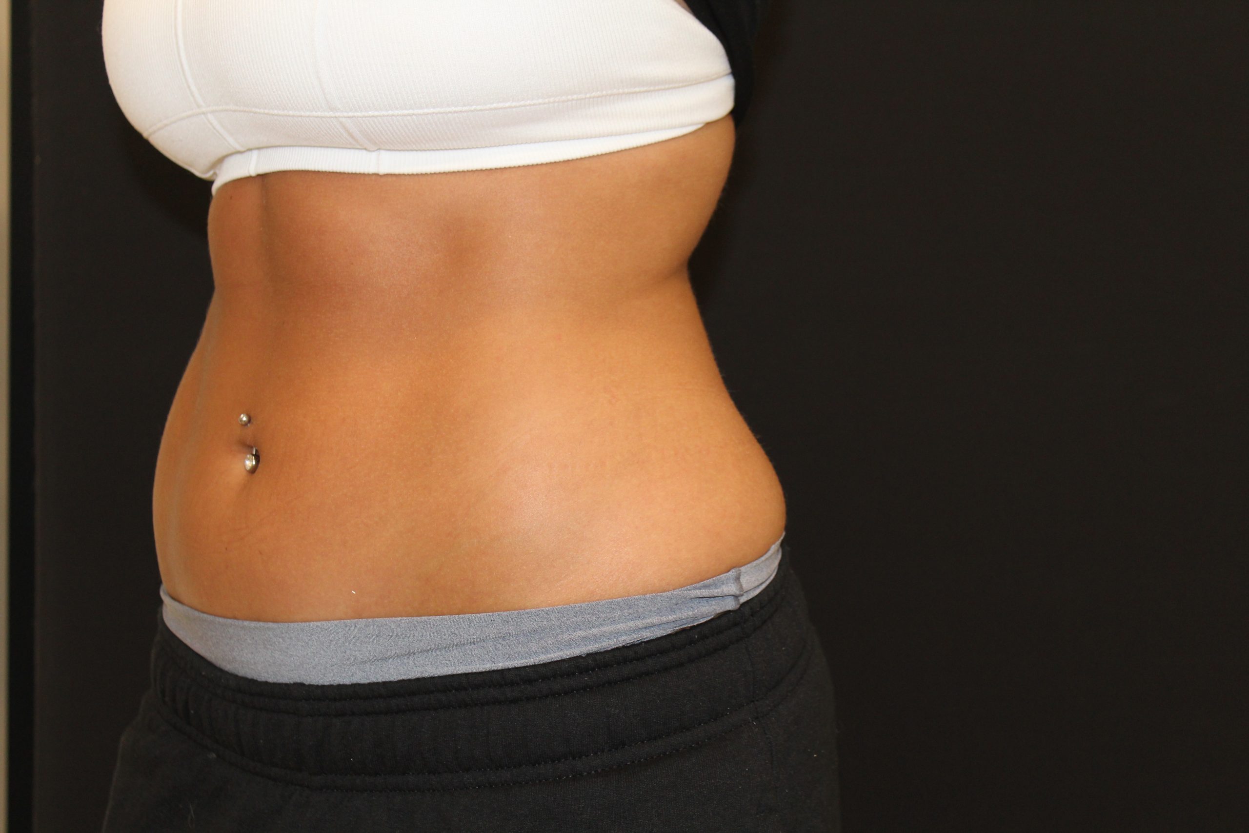 Patient 53 After Image