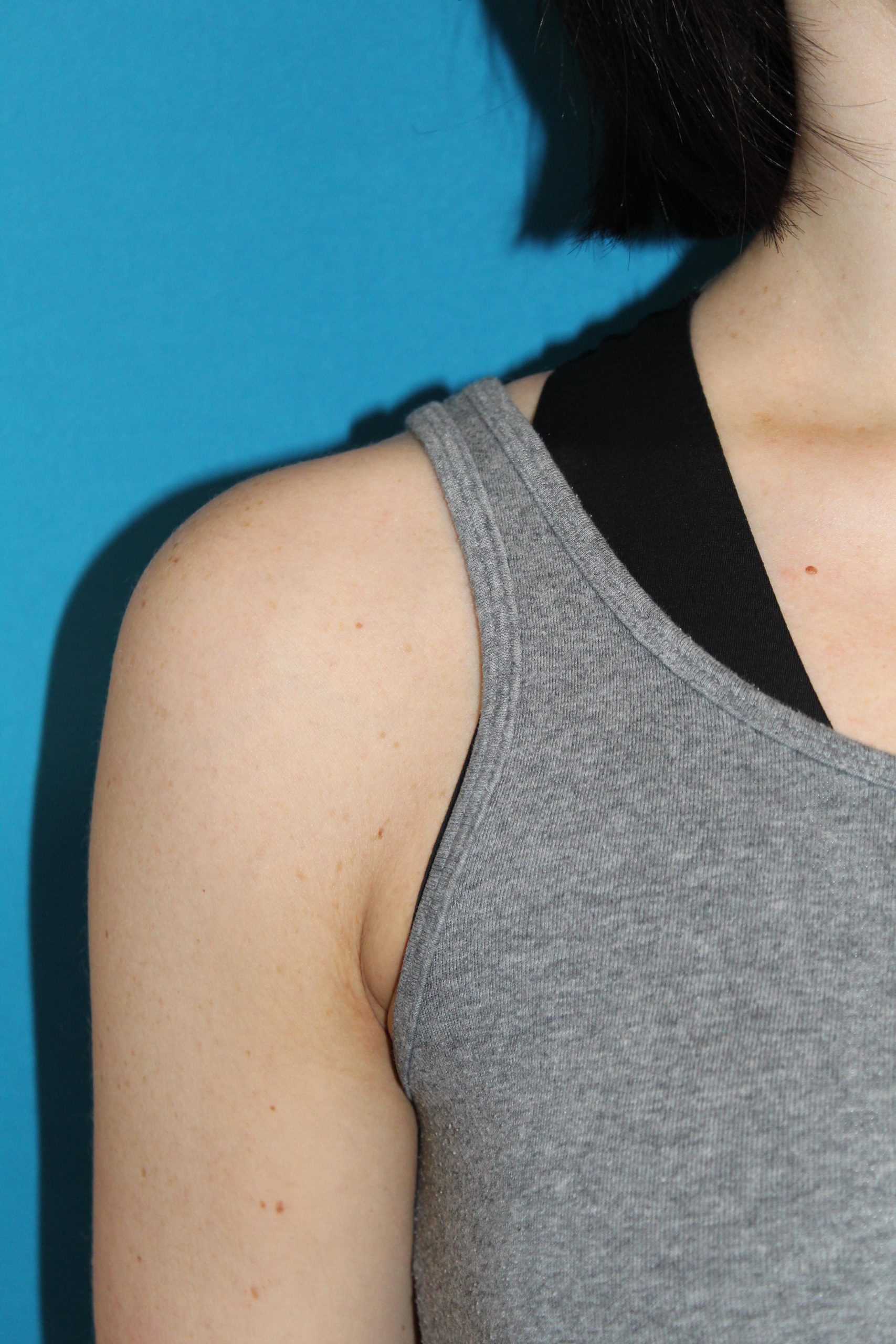 Patient 52 After Image