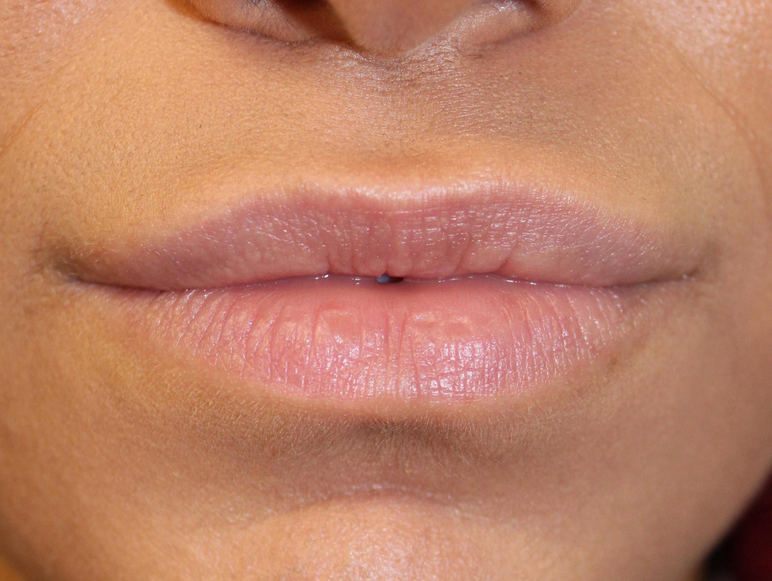 Patient 36 After Image