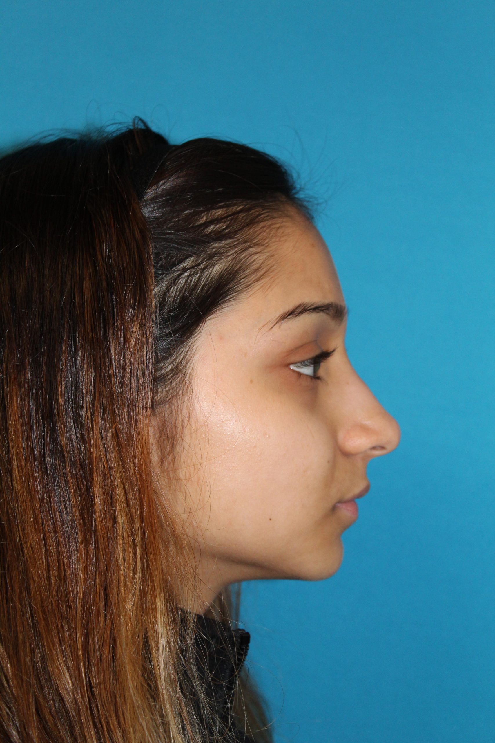 Patient 40 After Image