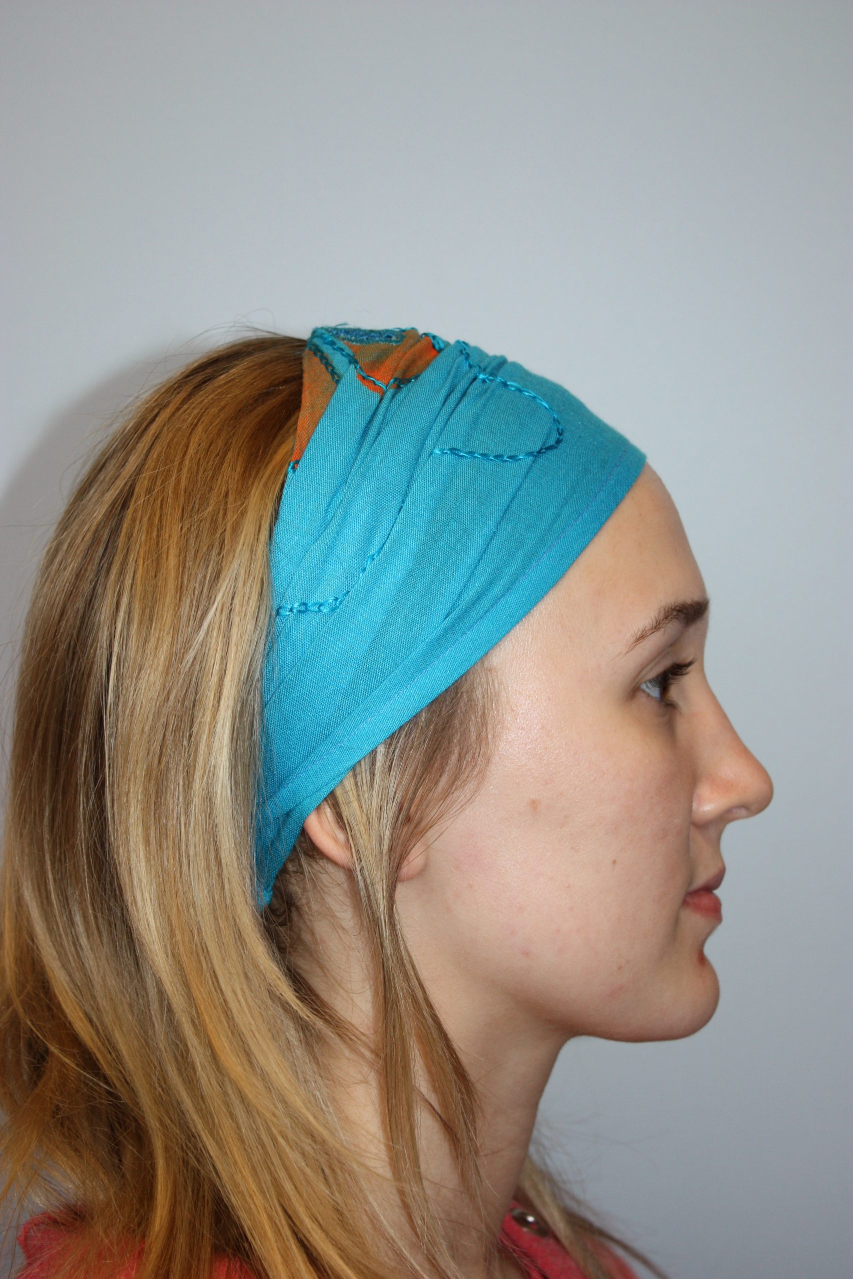 Patient 51 After Image