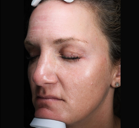 Patient 27 After Image