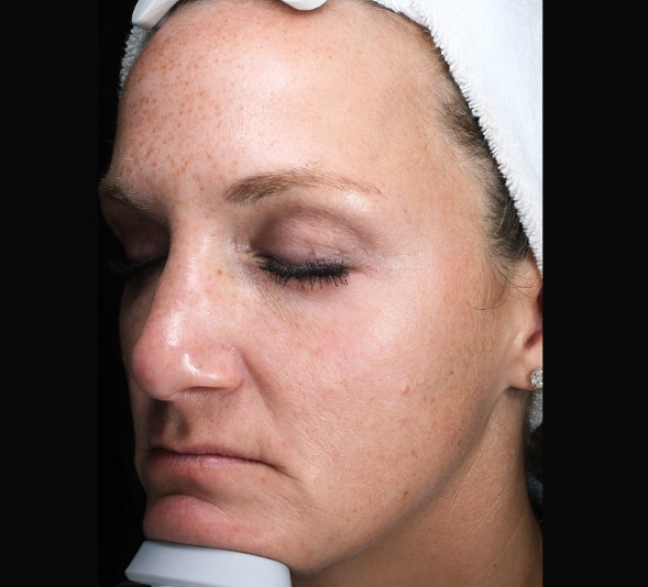 Patient 27 Before Image