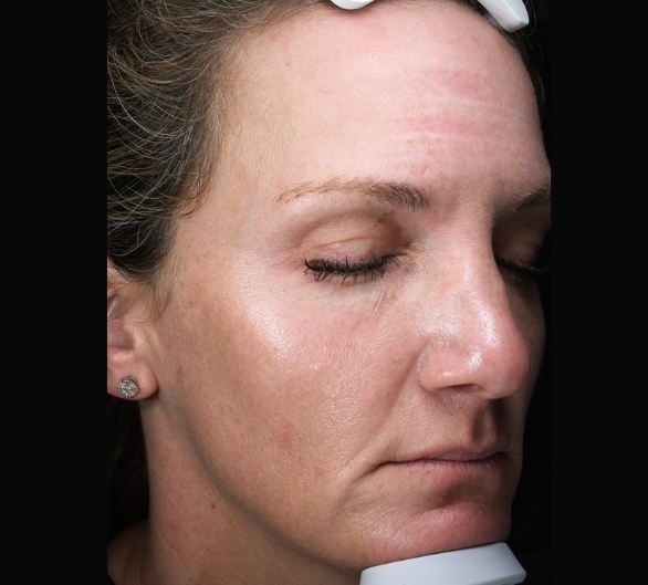 Patient 27 After Image