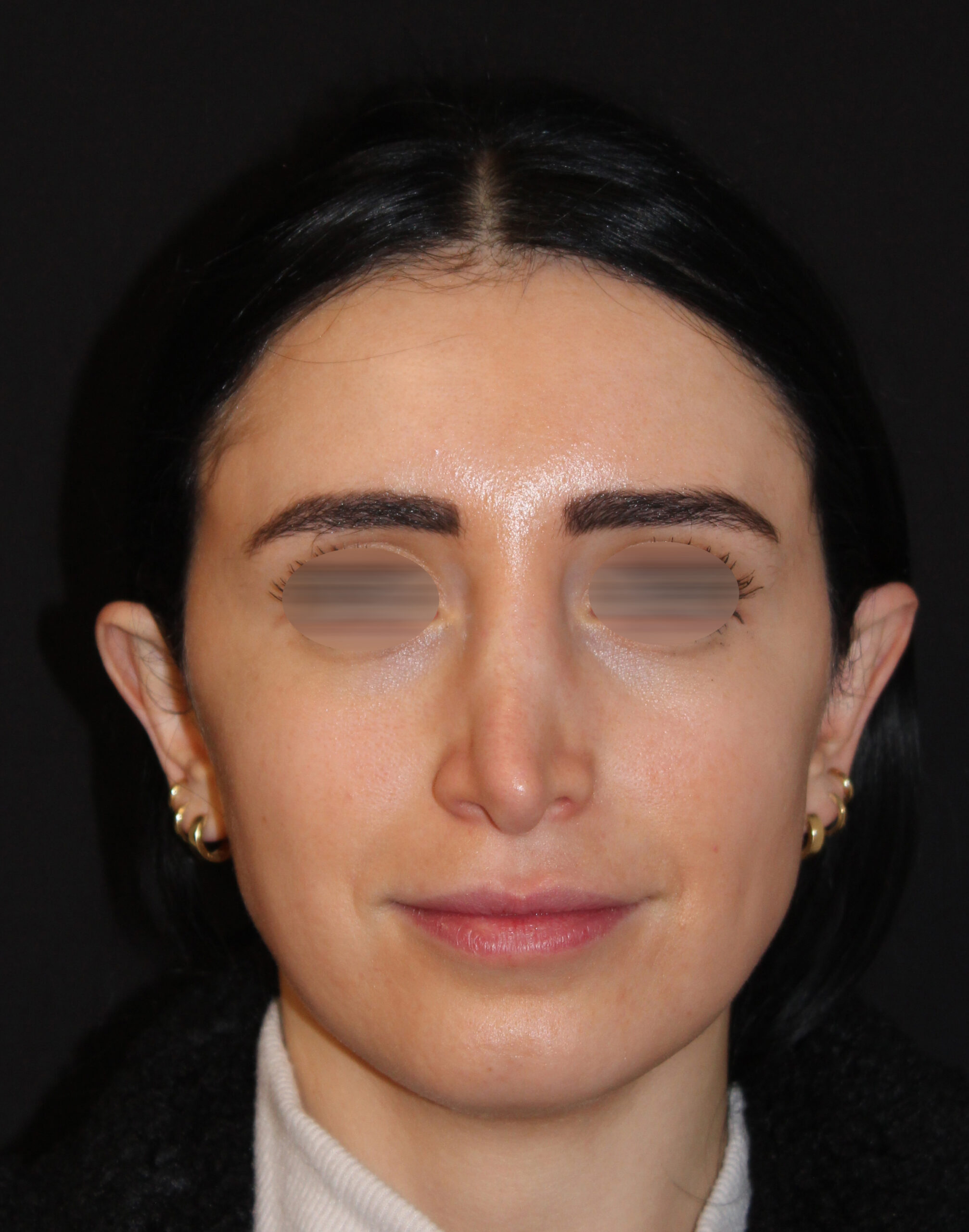 Patient #116 Before Image